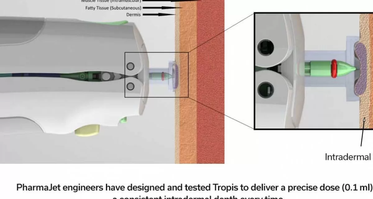 Needle-Free Polio Vaccinations Show Promise in Reducing Costs and Boosting Uptake