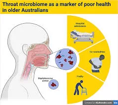 Throat Microbiome Offers Insights into Health Risks Among Older Australians