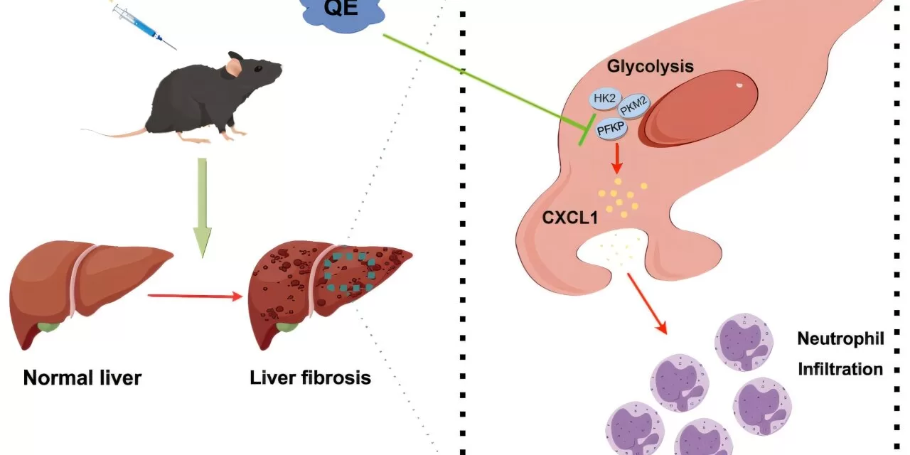 Quercetin: A Natural Solution with the Potential to Combat Liver Fibrosis