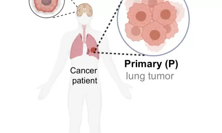 Natural Defense Mechanism May Help Slow Down Tumor Cell Metastasis