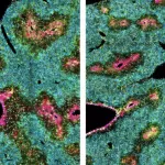 Secret Bosses” of the Liver: Star-Shaped Cells Vital for Health, Not Just Scarring