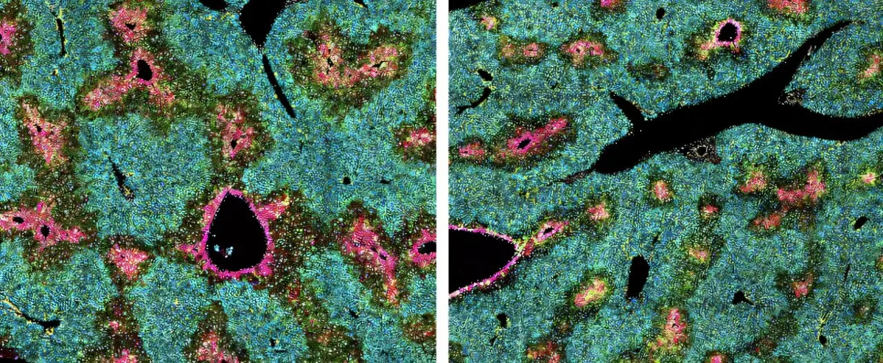 Secret Bosses” of the Liver: Star-Shaped Cells Vital for Health, Not Just Scarring