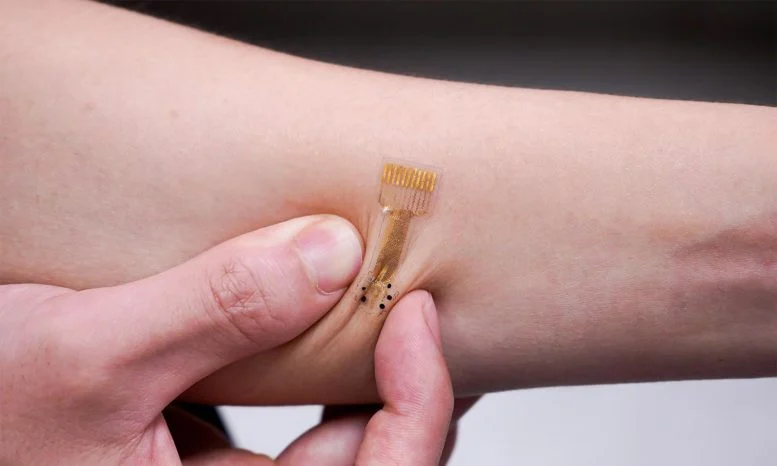 Caltech Researchers Develop Smart Bandage That Detects Infections Days in Advance