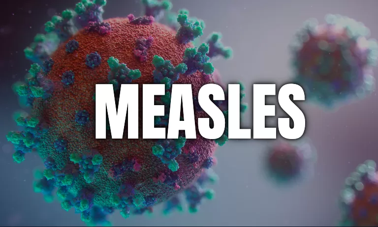 “Measles Alert in Sydney: What You Need to Know About Recent Exposure at CBD, Airport, and Major Concert”