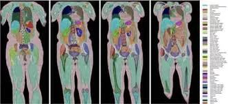 A New Lens on the Human Body: Light-Sound Hybrid Imaging Promises Rapid, Radiation-Free 3D Scans