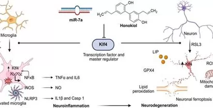 Towards a potential cure for Alzheimer’s Disease