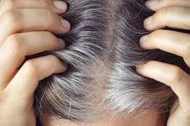 Gray Hair May Signal Robust Cellular Health, Not Just Aging, Study Shows