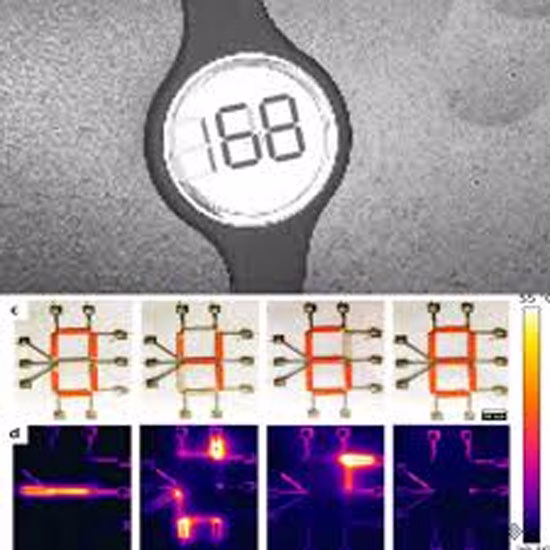 IIT Madras unveils affordable microneedle patch that displays glucose on-device, aiming to expand access to continuous monitoring