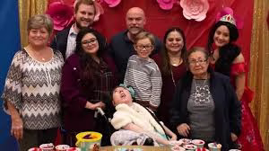 “Meet Alex Simpson: Born without a brain, defying all odds to turn 20—a true medical miracle”