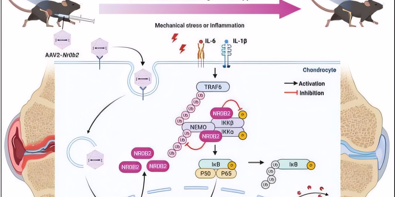 Protecting the Pivot: Discovery of Key Protein Offers New Hope for Reversing Osteoarthritis
