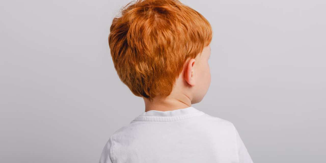 Red Hair Pigment May Do More Than Color Hair — It May Also Help Cells Manage a Toxic Amino Acid
