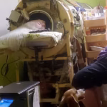 The Final Breath of a Polio Era: Last U.S. Iron Lung Survivor Martha Lillard Dies at 78