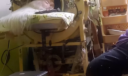 The Final Breath of a Polio Era: Last U.S. Iron Lung Survivor Martha Lillard Dies at 78
