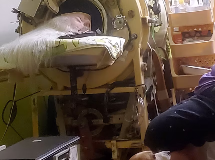 The Final Breath of a Polio Era: Last U.S. Iron Lung Survivor Martha Lillard Dies at 78